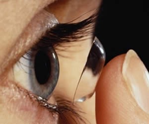 Colocación lente de contacto blanda