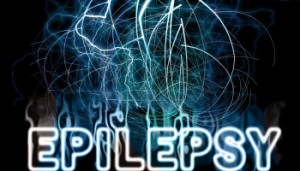 retraso diagnóstico en epilepsia 