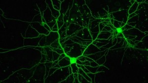 neuronas-cultivo-web_1
