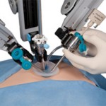 Sistema robótico para cirugía