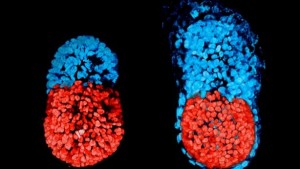 Embriones In vitro
