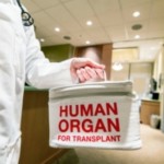 trasplante órganos