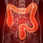 inflamación intestinal