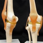 regeneración de rodilla