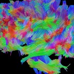 Cambios en la  estructura cerebral