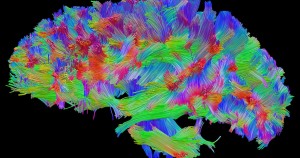 cambio estructura cerebral