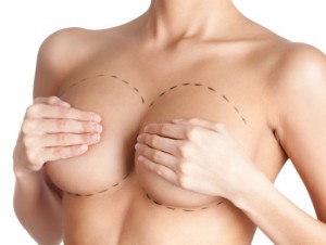 Tits correction. Plastic surgery