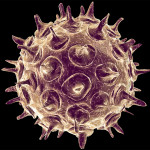 virus varicela