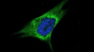 Expresión de LOXL2 en una línea celular de carcinoma de mama de tipo basal, mostrando la intensa tinción de LOXL2 (verde) rodeando al núcleo (azul). (DM)