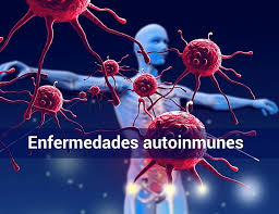 autoinmunes