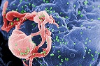 La detección de la proteína IP-10 en la sangre permite mejorar el diagnóstico de VIH cuando el paciente aún no presenta anticuerpos