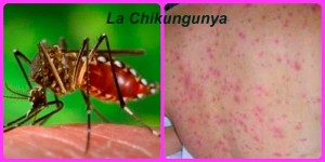 Fiebre-Chikungunya