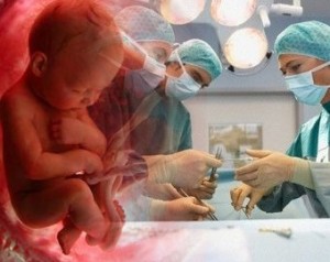 cirugía en fetos