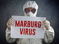 Uganda confirma un muerto por el virus de Marburgo