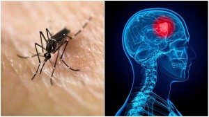 zika-virus-brain-cancer