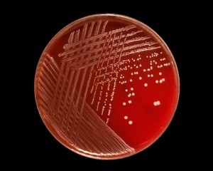 staphylococcus epidermidis