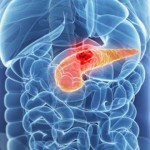  Una nueva terapia experimental consigue regresión completa en cáncer de páncreas