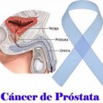 cancer-de-prostata1