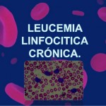 leucemias-linfoctica-introduccin-1-638