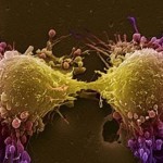 células tumorales