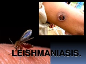 leishmaniasis-1-638