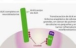 Nuevo paradigma para tumores ALK+