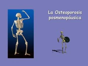 La Osteoporosis posmenopáusica