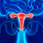 cancer_endometrio