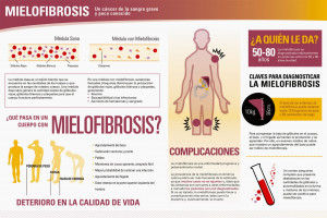 inforgrafía-mielofibrosis