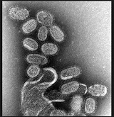 Los virus interactúan socialmente entre ellos para evadir al sistema inmunitario