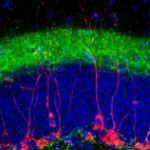 Tinción de células madre neurales en un hipocampo de ratón macho adulto 