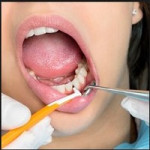 Los beneficios para la salud bucal de los tratamientos de ortodoncia