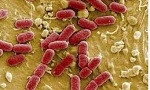 E.coli enterohemorrágica
