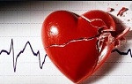 infarto agudo del miocárdio