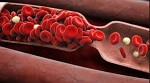 coágulos sanguíneos