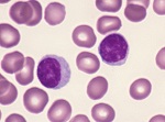 linfocitos en sangre