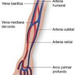 arteria mediana