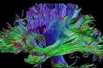 Imagen del cerebro por resonancia magnética