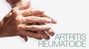 artritis-reumatoide