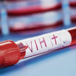79367-el-vih-no-ha-desaparecido-y-continua-transmitiendose-en-todo-el-mundo