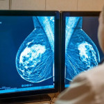 mamografia-768x508