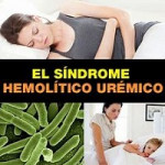 sindrome uremico hemolitico