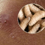 gusano barrenador del ganado