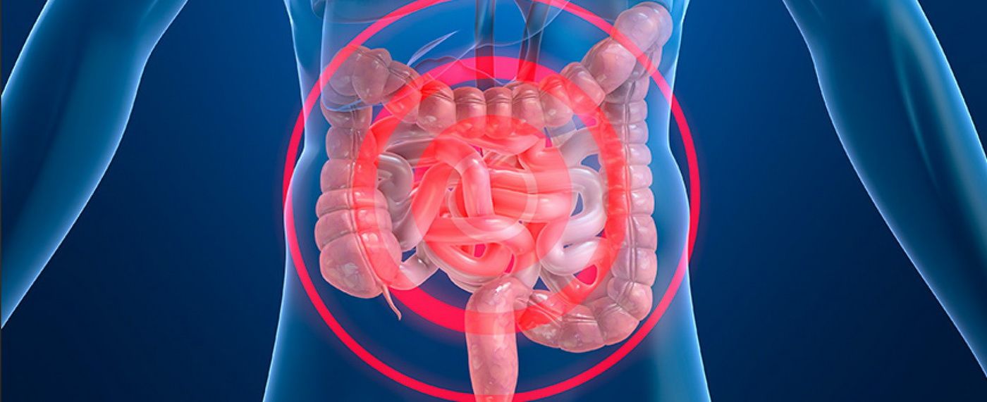 Disbiosis intestinal tratamiento natural